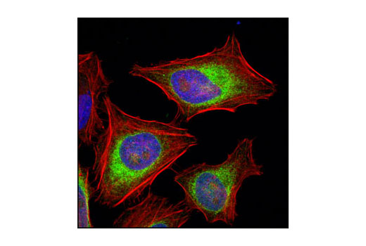 Confocal immunofluorescent analysis of HeLa cells using Calnexin (C5C9) Rabbit mAb (green). Actin filaments have been labeled using DY-554 phalloidin (red). Blue pseudocolor = DRAQ5 ® #4084 (fluorescent DNA dye).
