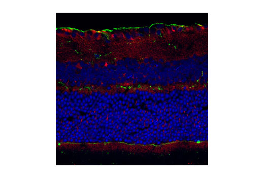 Confocal immunofluorescent analysis of mouse retina using Calpain 2 Large Subunit (M-type) Antibody (red) and Phospho-Tyrosine Mouse mAb (P-Tyr-100) #9411 (green). Blue pseudocolor = DRAQ5 ® #4084 (fluorescent DNA dye).