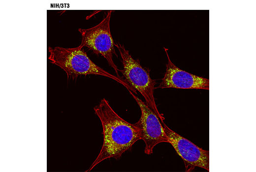 Confocal immunofluorescent analysis of NIH/3T3 cells using Calreticulin (D3E6) XP ® Rabbit mAb (green) and β-Actin (13E5) Rabbit mAb (Alexa Fluor ® 555 Conjugate) #8046 (red). Blue pseudocolor = DRAQ5 ® #4084 (fluorescent DNA dye).