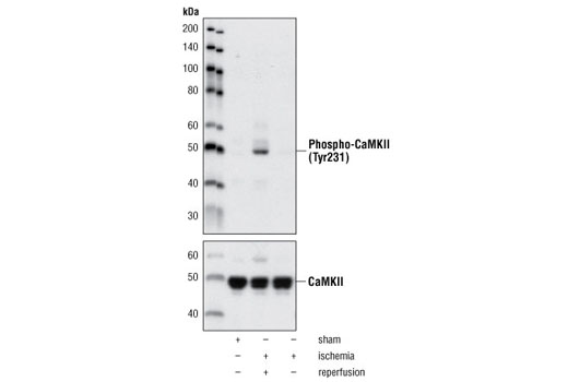Western blot analysis of extracts from rat brain, either sham-operated, 15 min ischemia followed by 4 h reperfusion or 15 min ischemia only, using Phospho-CaMKII (Tyr231) Antibody (upper) or CaMKII Antibody (lower).