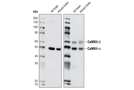 Western blot analysis of extracts from rat and mouse brain using CaMKII-α Antibody (left) and CaMKII pan #3362 (right).