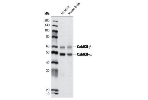Western blot analysis of extracts from rat and mouse brain using CaMKII (pan) Antibody.