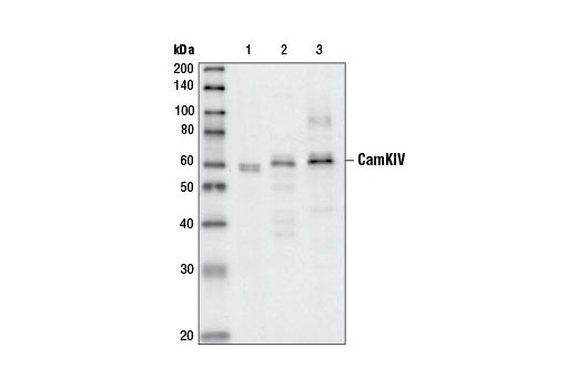 Western blot analysis of extracts from human Jurkat cells (lane1), rat brain (lane 2) and mouse brain (lane 3), using CaMKIV Antibody.