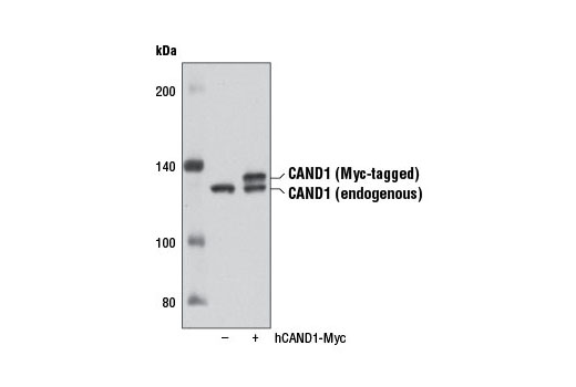 Western blot analysis of extracts from 293T cells, either mock transfected (-) or transfected with a Myc-tagged cDNA expression construct encoding full-length human CAND1 (hCAND1-Myc, +), using CAND1 (D1F2) Rabbit mAb.