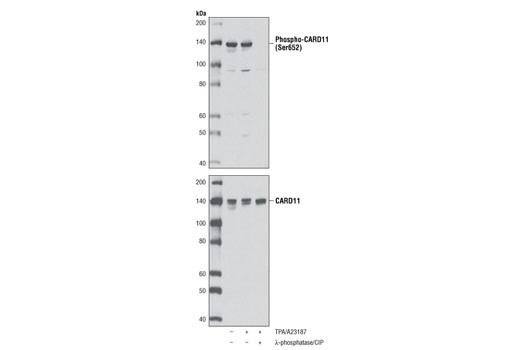 Western blot analysis of extracts from Jurkat cells, untreated or treated with TPA #9905 (40 nM) and calcium ionophore A23187 (2 μM) for 15 minutes, and λ-phosphatase plus calf intestinal phosphatase (CIP) as indicated, using Phospho-CARD11 (Ser652) Antibody (upper) and CARD11 (1D12) Rabbit mAb #4435 (lower).