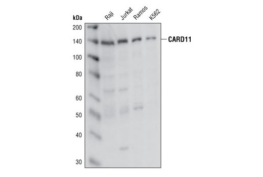 Western blot analysis of extracts from Raji, Jurkat, Ramos and K562 cells, using CARD11 Antibody.