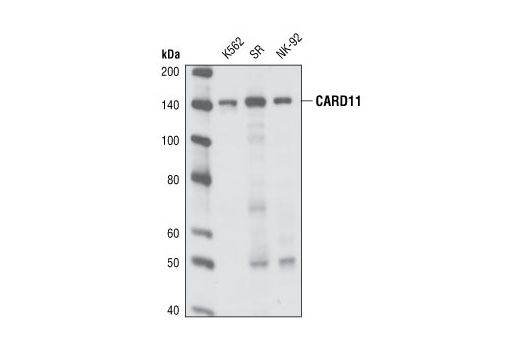 Western blot analysis of extracts from K562, SR and NK-92 cell lines, using CARD11 (1D12) Rabbit mAb.