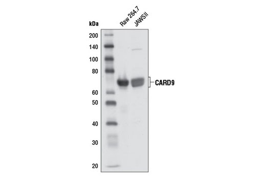 Western blot analysis of extracts from Raw 264.7 and JAWSII cells using CARD9 Antibody (Mouse Preferred).