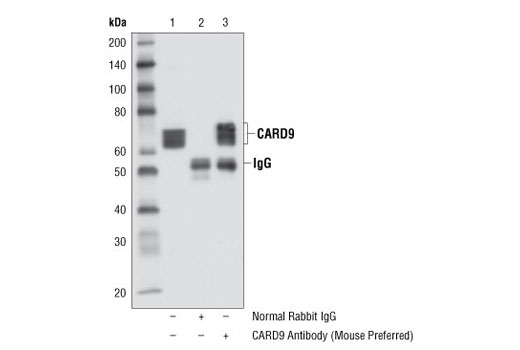 Immunoprecipitation of CARD9 from Raw 264.7 cell extracts using Normal Rabbit IgG #2729 (lane 2) or CARD9 Antibody (Mouse Preferred) (lane 3). Lane 1 is 10% input. Western blot analysis was performed using CARD9 Antibody (Mouse Preferred).