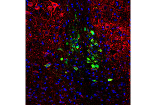 Confocal immunofluorescent analysis of the hypothalamic region of normal mouse brain using CART (D6L8J) Rabbit mAb (green) and β3-Tubulin (TU-20) Mouse mAb #4466 (red). Blue pseudocolor = DRAQ5 ® #4084 (fluorescent DNA dye).