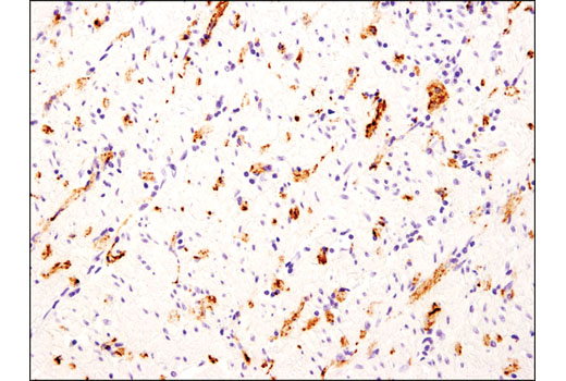 Immunohistochemical analysis of paraffin-embedded human muscularis propria adjacent to colon tumor using CART (D6M2M) Rabbit mAb.