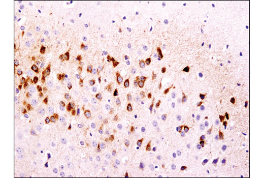 Immunohistochemical analysis of paraffin-embedded mouse brain using CART (D6M2M) Rabbit mAb.