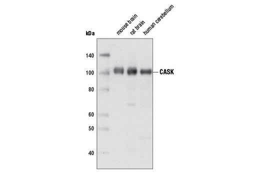 Western blot analysis of extracts from various tissues using CASK (D24B12) Rabbit mAb.
