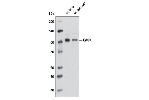 Western blot analysis of extracts from rat and mouse brain using CASK (D38F6) Rabbit mAb.