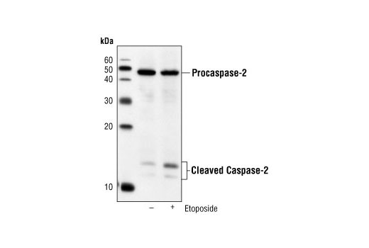 Western blot analysis of extracts from Jurkat cells, untreated or etoposide-treated (5 hr, 25μM), using Caspase-2 (C2) Mouse mAb.
