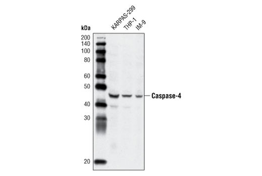 Western blot analysis of extracts from KARPAS-299, THP-1 and IM-9 cells using Caspase-4 Antibody.