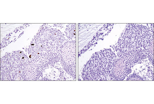 Immunohistochemical analysis of paraffin-embedded E14 mouse embryo using Cleaved Caspase-3 (Asp175) (D3E9) Rabbit mAb #9579 (left) or Rabbit (DA1E) mAb IgG XP ® SignalStain ® Isotype Control #12960 (right).