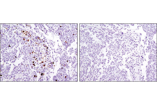 Immunohistochemical analysis of paraffin-embedded Kelly xenograft using Cleaved Caspase-3 (Asp175) (D3E9) Rabbit mAb #9579 (left) or Rabbit (DA1E) mAb IgG XP ® SignalStain ® Isotype Control #12960 (right).