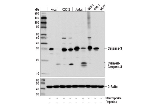 Western blot analysis of various cell lines, untreated (-) or treated with Staurosporine #9953 (1 μM; 3 hr) or with Etoposide #2200 (25 μM, overnight), using Caspase-3 (D3R6Y) Rabbit mAb (upper) or β-Actin (D6A8) Rabbit mAb #8457 (lower). MCF7 cells are negative for caspase-3 expression.