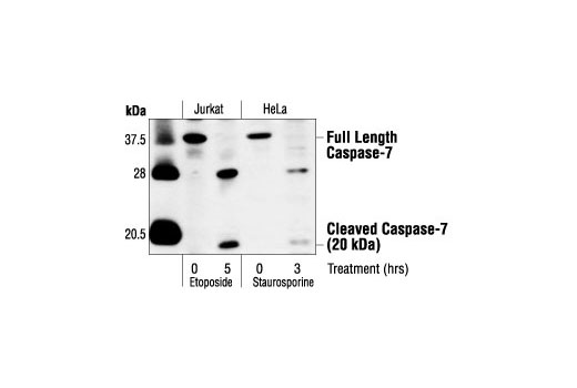Western blot analysis of extracts from Jurkat cells, untreated or etoposide-treated (25 µM), and HeLa cells, untreated or staurosporine-treated (1 µM), using Caspase-7 Antibody.