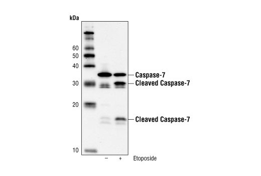 Western blot analysis of extract from Jurkat cells, untreated or etoposide-treated, using Caspase-7 (C7) Mouse mAb (Human Specific).