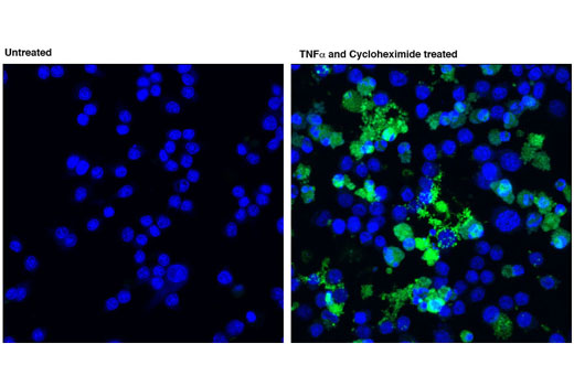 Confocal immunofluorescent analysis of Raw 264.7 cells, untreated (left) or treated with TNF-α and Cycloheximide (20 ng/ml and 2.5 ug/ml, 4 hours and 3 hours; right), using Cleaved Caspase-8 (Asp387) (D5B2) XP ® Rabbit mAb (Mouse Specific) (green). Blue pseudocolor = DRAQ5 ® #4084 (fluorescent DNA dye).