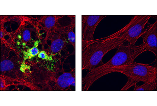 Confocal immunofluorescent analysis of NIH/3T3 cells, staurosporine-treated (left) or untreated (right), using Cleaved Caspase-9 (Asp353) Antibody (Mouse Specific) (green). Actin filaments have been labeled with Alexa Fluor® 555 phalloidin (red). Blue pseudocolor = DRAQ5® #4084 (fluorescent DNA dye).