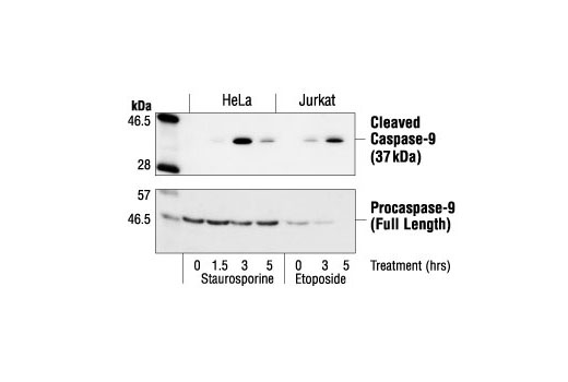 Western blot analysis of HeLa cells, untreated or staurosporine-treated (1 µM), and Jurkat cells, untreated or etoposide-treated, using Cleaved Caspase-9 (Asp330) Antibody (Human Specific) (upper) or Caspase-9 Antibody #9502 (Human Specific) (lower).