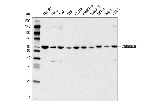 Western blot analysis of extracts from various cell lines using Catalase (D5N7V) Rabbit mAb.