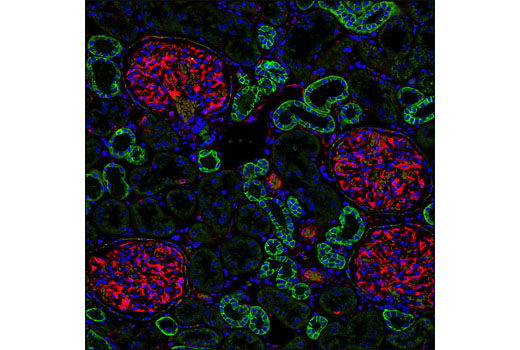 Confocal immunofluorescent analysis of paraffin-embedded human kidney using PathScan® EMT Duplex IF Kit. Green = E-cadherin, red = vimentin, and blue pseudocolor = DRAQ5® #4084 (fluorescent DNA dye).