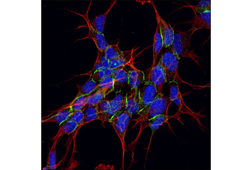 Confocal immunofluorescent analysis of SH-SY5Y cells using α-N-Catenin Antibody (green). Actin filaments have been labeled with DY-554 phalloidin (red). Blue pseudocolor = DRAQ5®#4084 (fluorescent DNA dye).