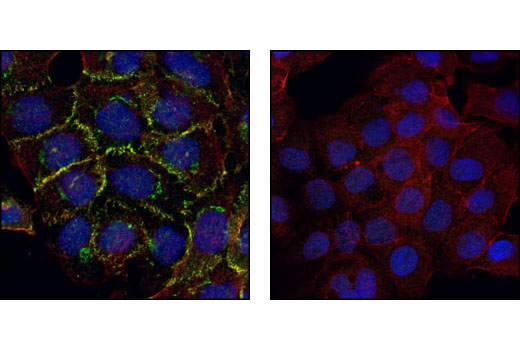 Confocal immunofluorescent analysis of A-431 cells labeled with α-E-Catenin Antibody (green, left) compared to an isotype control (right). Actin filaments have been labeled with phalloidin (red). Blue pseudocolor = TO-PRO-3 (fluorescent DNA dye).