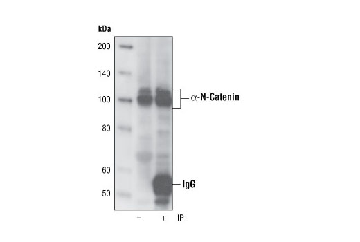 Immunoprecipitation of α-N-Catenin from SH-SY5Y cell lysates using α-N-Catenin (C12G4) Rabbit mAb. Western blot was performed using the same antibody.