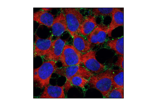 Confocal immunofluorescent analysis of SH-SY5Y cells using α-N-Catenin (C12G4) Rabbit mAb (green) and S6 Ribosomal Protein (54D2) Mouse mAb #2317 (red). Blue pseudocolor = DRAQ5™ (fluorescent DNA dye).
