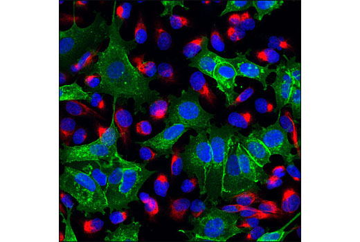 Confocal immunofluorescent analysis of cocultured MCF7 and MDA-MB-231 cells using PathScan® EMT Duplex IF Kit. Green = E-cadherin, red = vimentin, and blue pseudocolor = DRAQ5® #4084 (fluorescent DNA dye).