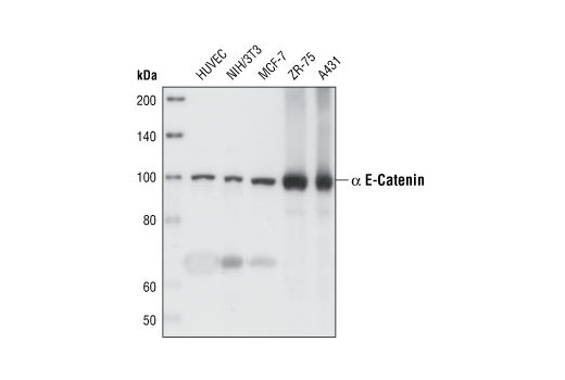 Western blot analysis of extracts from HUVEC, NIH/3T3, MCF-7, ZR-75 and A431 cells using α-E-Catenin (23B2) Rabbit mAb.