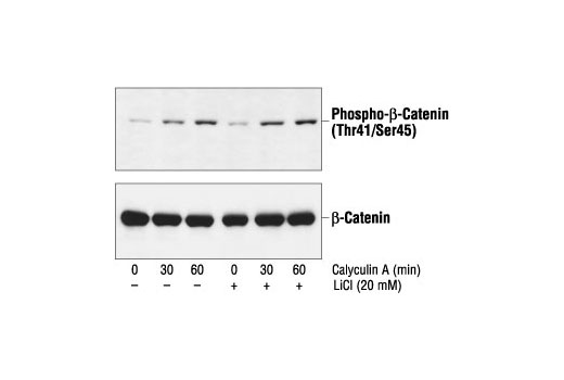 Western blot analysis of extracts from 293 cells pretreated with 20 mM LiCl for 30 minutes and then with 50 nM calyculin A, using Phospho-β-Catenin (Thr41/Ser45) Antibody (upper) or β-Catenin Antibody #9562 (lower).