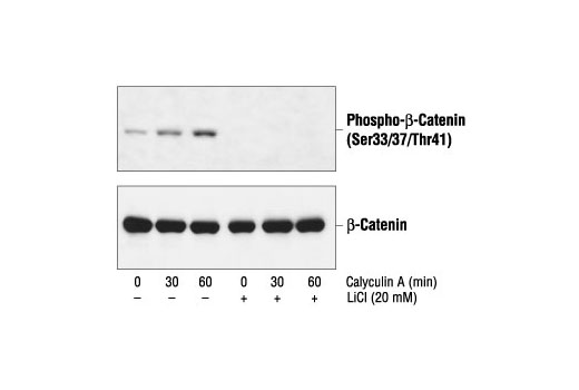 Western blot analysis of extracts from 293 cells, pretreated with 20 mM LiCl for 30 minutes and then with 50 nM calyculin A, using Phospho-β-Catenin (Ser33/37/Thr41) Antibody (upper) or β-Catenin Antibody #9562 (lower).