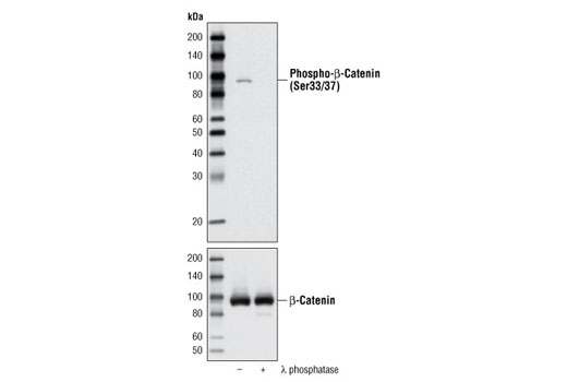 Western blot analysis of extracts from SW620 cells, untreated or treated with λ phosphatase, using Phospho-β-Catenin (Ser33/37) Antibody.