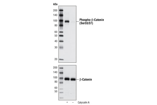 Western blot analysis of extracts from SW620 cells, untreated or treated with Calyculin A #9902, using Phospho-β-Catenin (Ser33/37) Antibody.