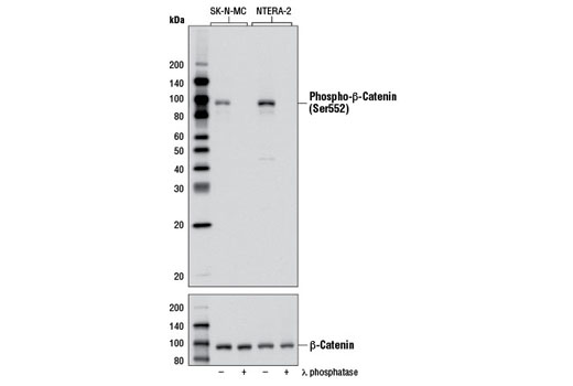 Western blot analysis of extracts from SK-N-MC and NTERA-2 cells, untreated or λ phosphatase-treated, using