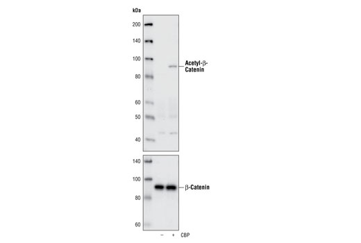 Western blot analysis of total cell lysates from 293 cells, untransfected or transiently transfected with a construct expressing CBP, using Acetyl-β-Catenin (Lys49) Antibody (Top), or total β-Catenin Antibody (Amino-terminal Antigen) #9581 (Bottom).