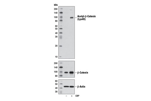 Western blot analysis of extracts from 293T cells, mock transfected (-) or transfected with a construct expressing CBP (+), using Acetyl-β-Catenin (Lys49) (D7C2) Rabbit mAb (upper), β-Catenin (D10A8) XP ® Rabbit mAb #8480 (middle), and β-Actin (D6A8) Rabbit mAb #8457 (lower).