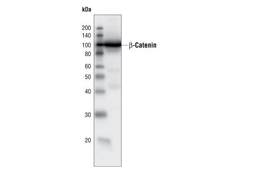 Western blot analysis of extracts from SW480 cells using β-Catenin Antibody.