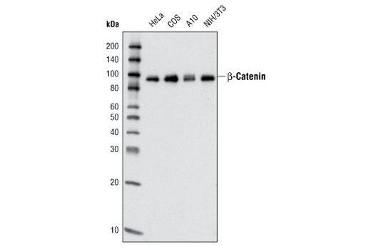 Western blot analysis of extracts from various cell lines using β-Catenin (L87A12) Mouse mAb.