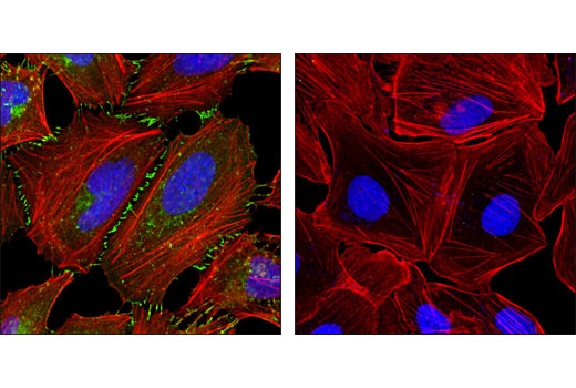 Confocal immunofluorescent analysis of HeLa (left) and NCI-H28 cells (right) using β-Catenin (L54E2) Mouse mAb
