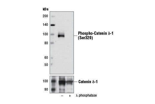 Western blot analysis of extracts from A-431 cells, untreated (-) or treated with λ phosphatase (+), using Phospho-Catenin δ-1 (Ser320) Antibody (upper) and Catenin δ-1 Antibody #4989 (lower).