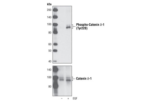 Western blot analysis of extracts from A431 cells, serum-starved overnight and then either left untreated or treated with EGF for 15 minutes, using Phospho-Catenin δ-1 (Tyr228) Antibody (upper) and Catenin δ-1 Antibody #4989 as a loading control (lower).