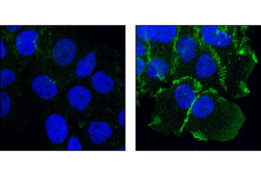 Confocal immunofluorescent analysis of A431 cells, serum-starved (left) or EGF-treated (right), using Phospho-Catenin δ-1 (Tyr228) Antibody (green). Blue pseudocolor = DRAQ5™ (fluorescent DNA dye).