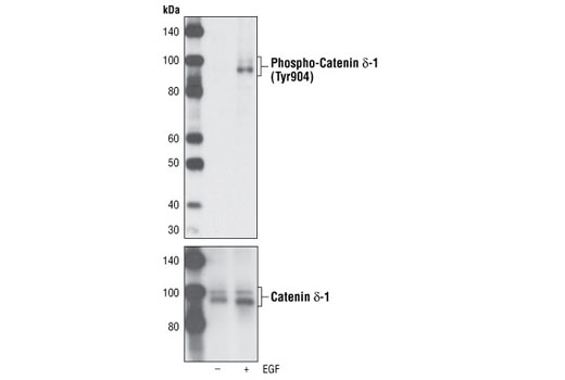 Western blot analysis of extracts from overnight serum starved A431 cells, untreated or EGF-treated for 15 minutes, using Phospho-Catenin δ-1 (Tyr904) Antibody (upper) and Catenin δ-1 Antibody #4989 as a loading control (lower).